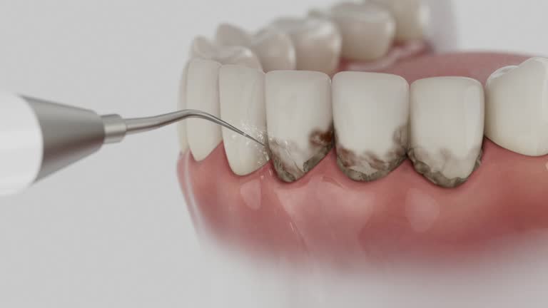 Reliable Invisalign Clear Aligners contractor in Vigo County County, IN by Dentist Open Now